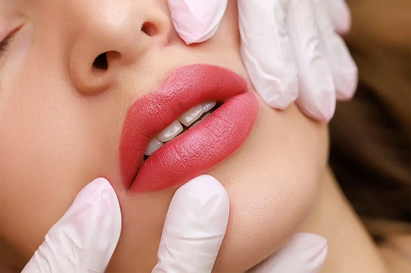 لیپ لیفت چیست و چه فوایدی دارد؟