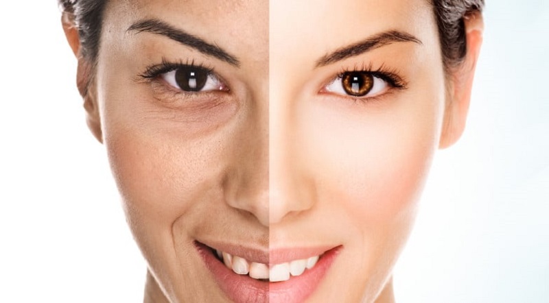 تزریق چربی: روشی طبیعی برای جوانسازی و حجم‌دهی چهره