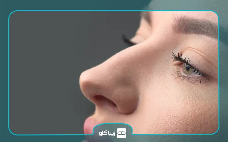 بینی استخوانی