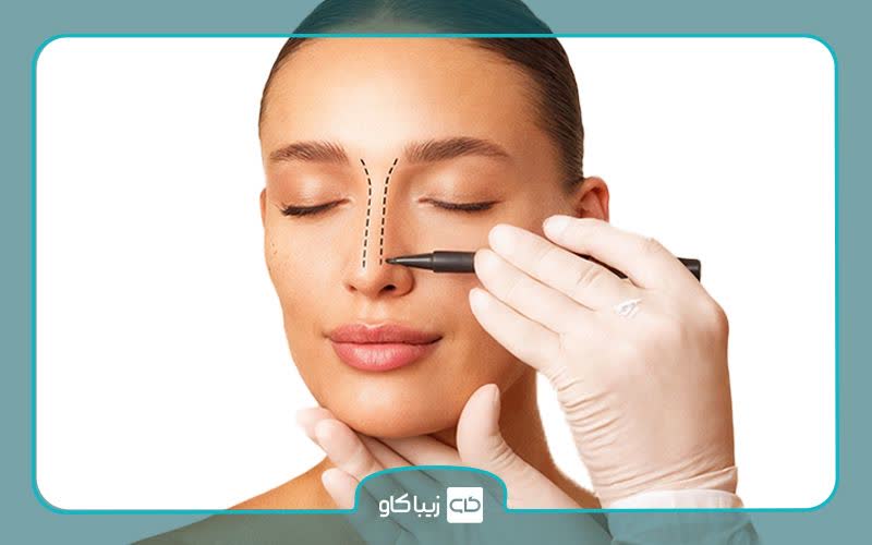 ارتفاع بینی