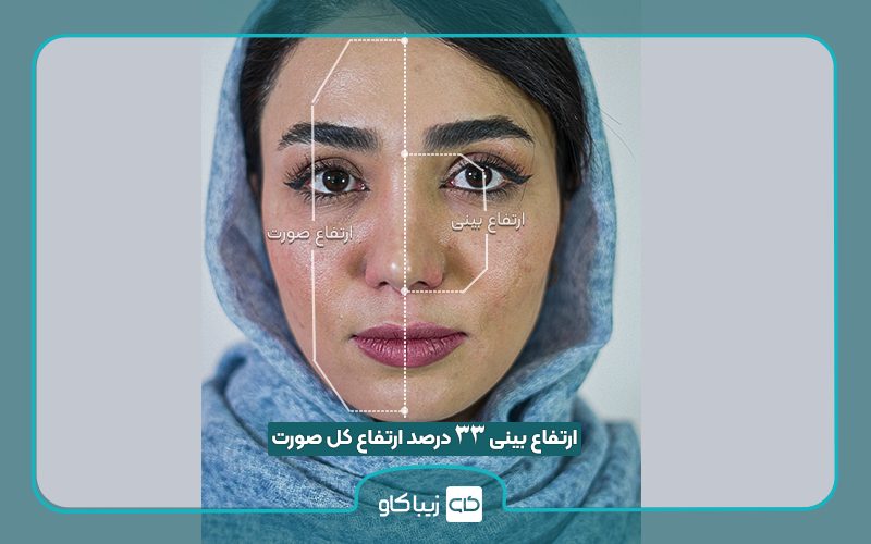 استاندارد زیبایی بینی