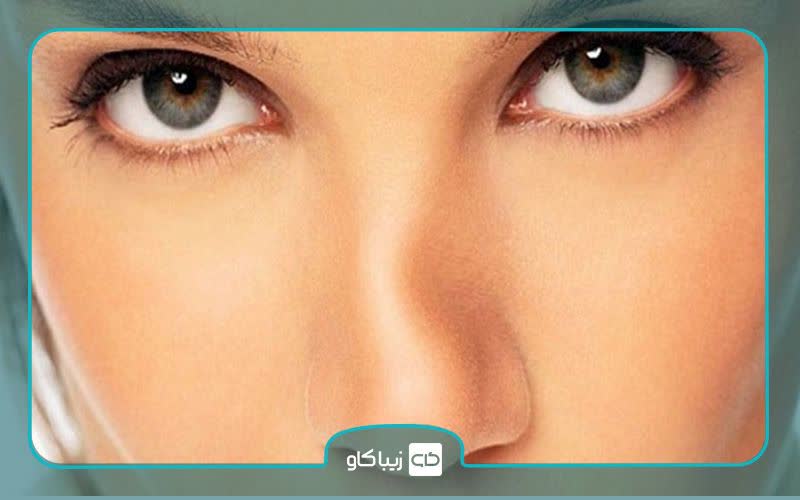 درمان کجی تیغه بینی